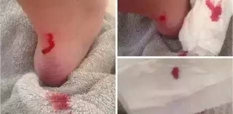 每个女生脚后跟都有个疤,每个女人的背后都有一部辛酸史