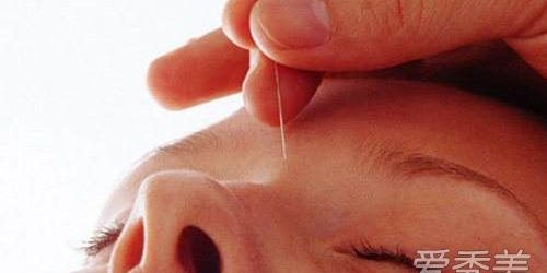 针灸瘦脸视频教程,针灸瘦脸有什么副作用