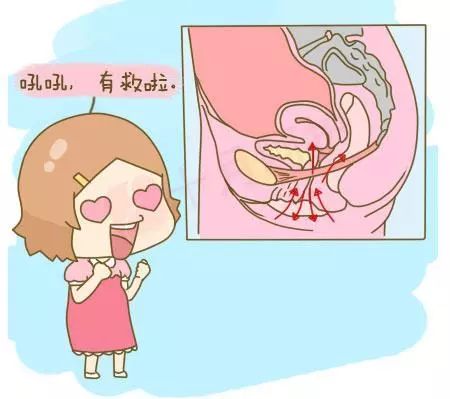 产后修复盆底肌凯格尔运动广告,产后多久可以做盆底肌修复运动