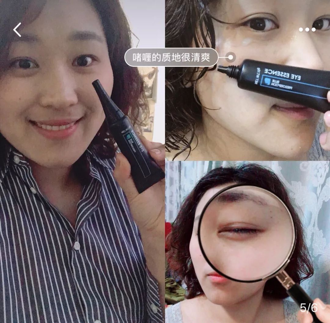 能去脂肪粒的眼霜,又能去纹又能去黑眼圈的眼霜