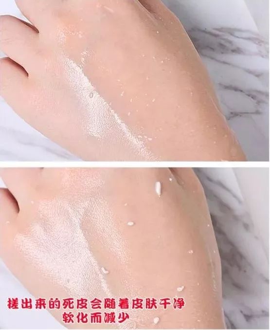 教你搞定肤色暗沉问题,肤色暗沉无光泽怎么改善