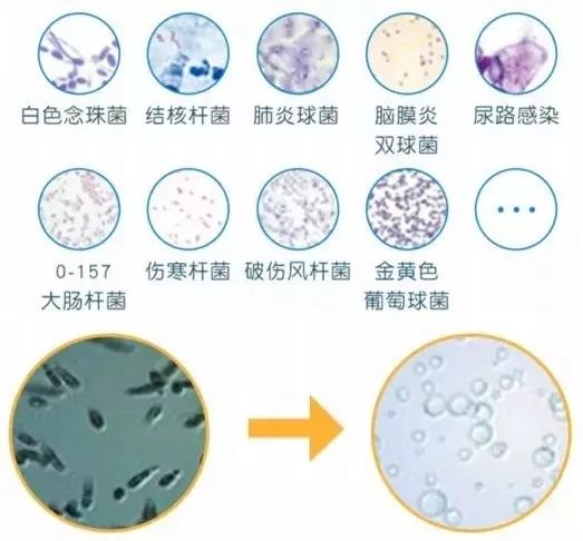 把洗衣机的残渣污垢排出来,洗衣机的洗涤盒的水垢
