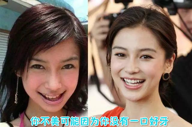 消炎止血牙膏哪一种好,止血牙膏推荐