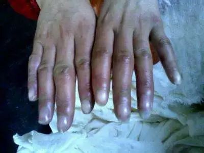 药店一块钱一粒的止疼药叫什么,药店几块钱的药膏