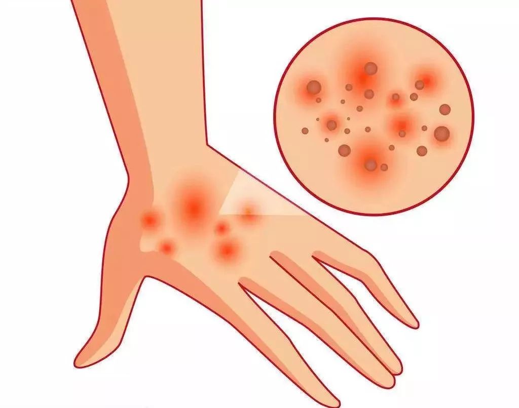 药店一块钱一粒的止疼药叫什么,药店几块钱的药膏