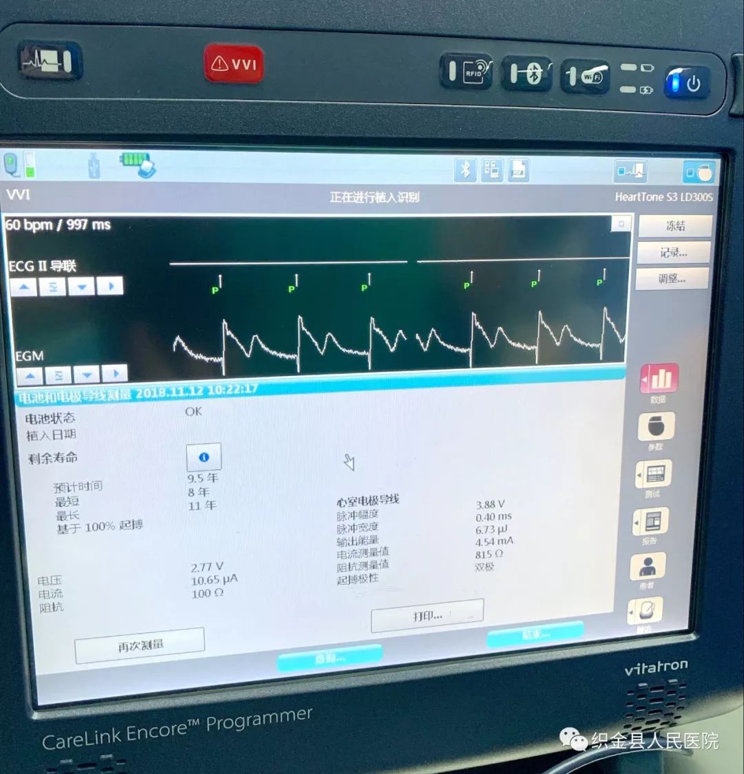 最新心脏起搏器植入示意图,心脏起搏器手术最好前十名医院