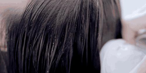 疯狂掉头发发际线后移,疯狂掉头发头发变得稀疏