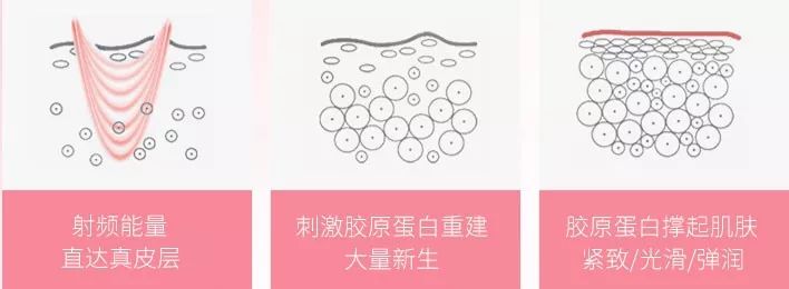 科普今年最火的美容仪真的有用吗,最近很火的美容仪有什么区别