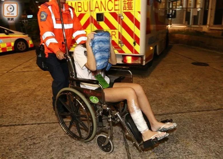 过生日被烫伤意味着什么,大学生吃火锅被烧伤