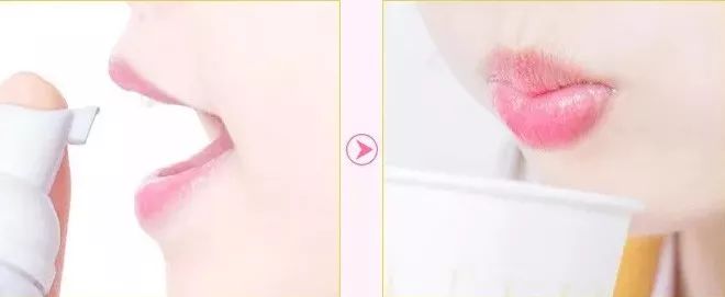 闭着嘴巴一会就干有异味,闭着嘴巴都感觉口腔有异味