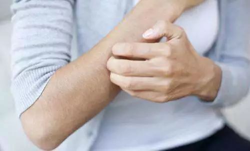 夜交藤外用治哪些病,小柴胡汤治疗皮肤瘙痒