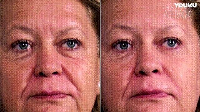 一分钟提拉紧致去除眼袋皱纹,修眼袋祛皱纹神器