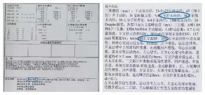 拯救反复心梗发作后心衰患者，积极血运重建和规范药物治疗一个都不能少！
