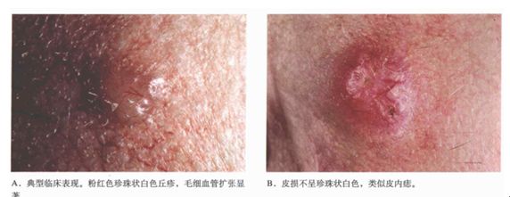 你说不“痣”道的事！