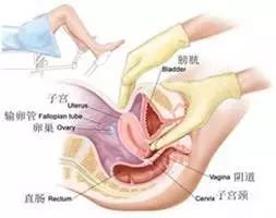 妇科最佳检查日期,春季适合查妇科