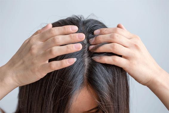 养发防脱拯救发际线洗发水,生发发际线的神器测评