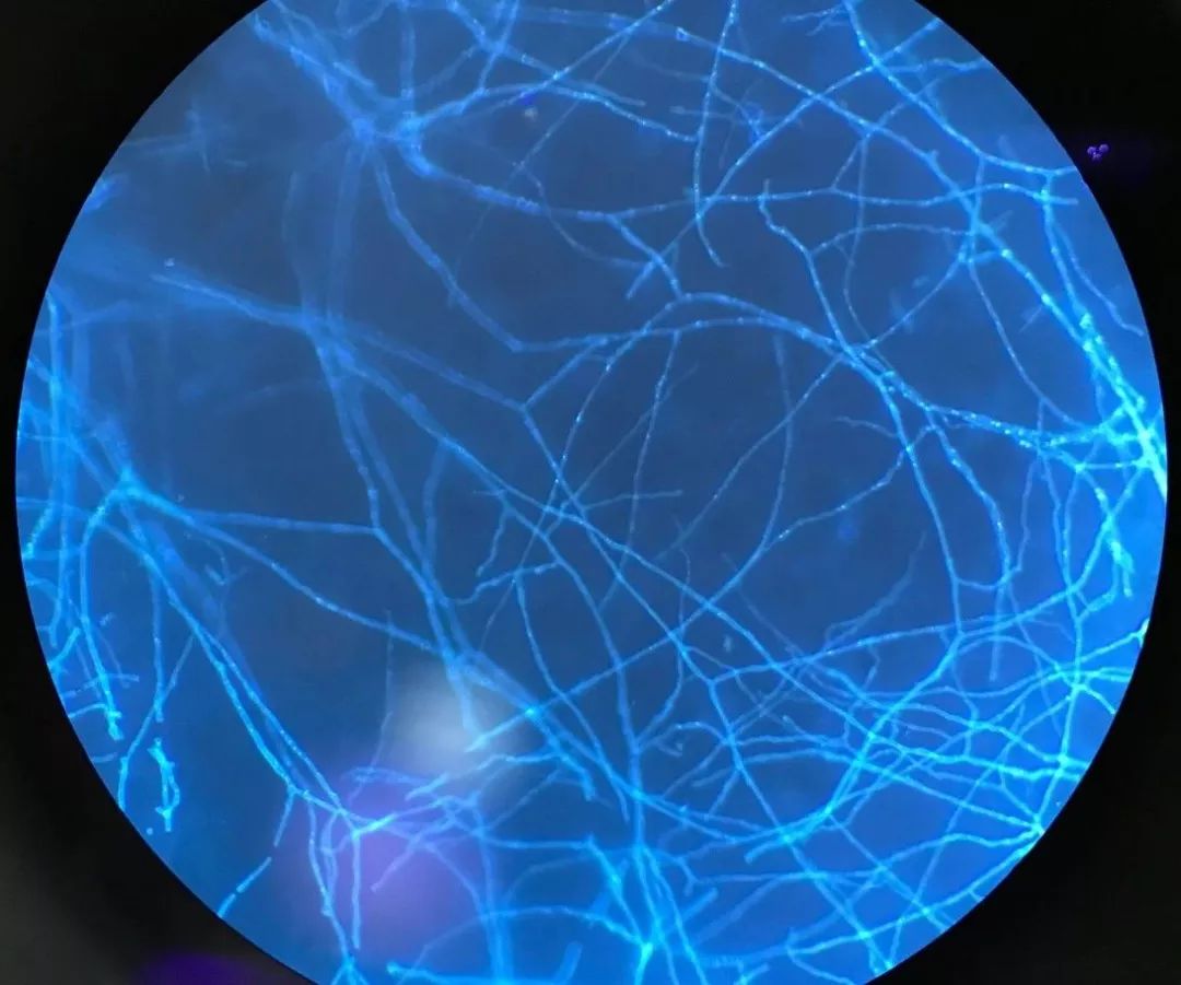 猫癣传染了给人该怎么办,人被传染上猫癣能用皮特芬吗