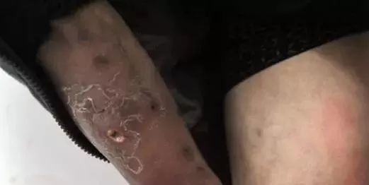 吸毒者最明显的特征是什么,吸毒的人最明显的特征是什么