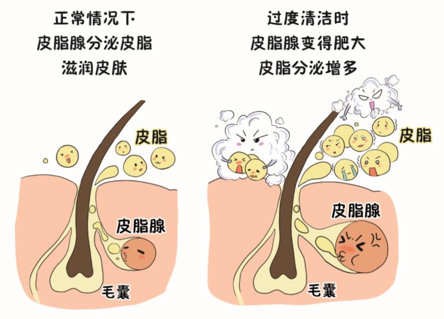 香皂洗脸的好处与坏处,香皂洗脸毁脸吗