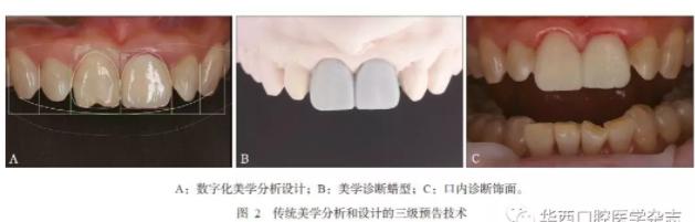 深度：3D打印在口腔美学修复中的应用