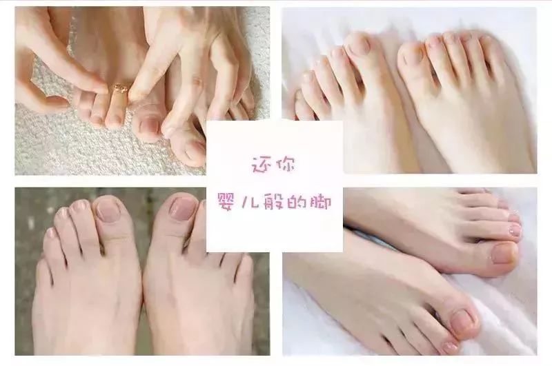 脚后跟干裂修复霜去死皮,脚干裂脱皮修复霜