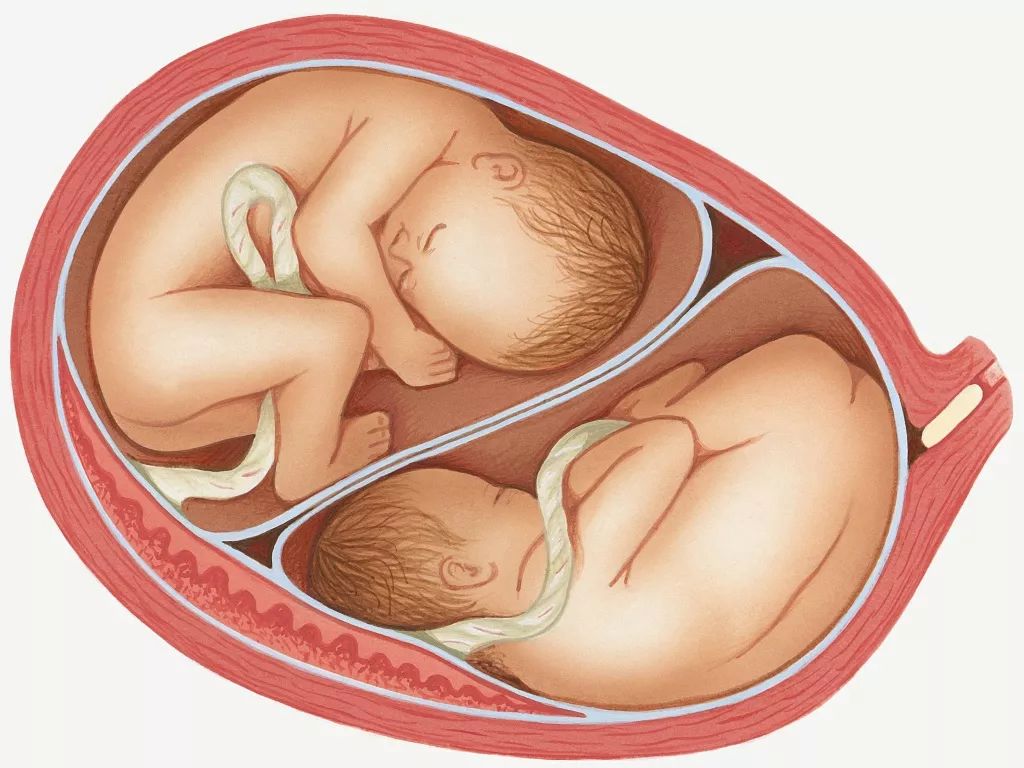 双胞胎同时母乳喂养方法,生双胞胎可以不母乳喂养