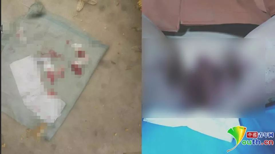 甘肃8岁女生被打致*体下**出血！官方：两名男同学用笤帚把所伤，涉事校长免职