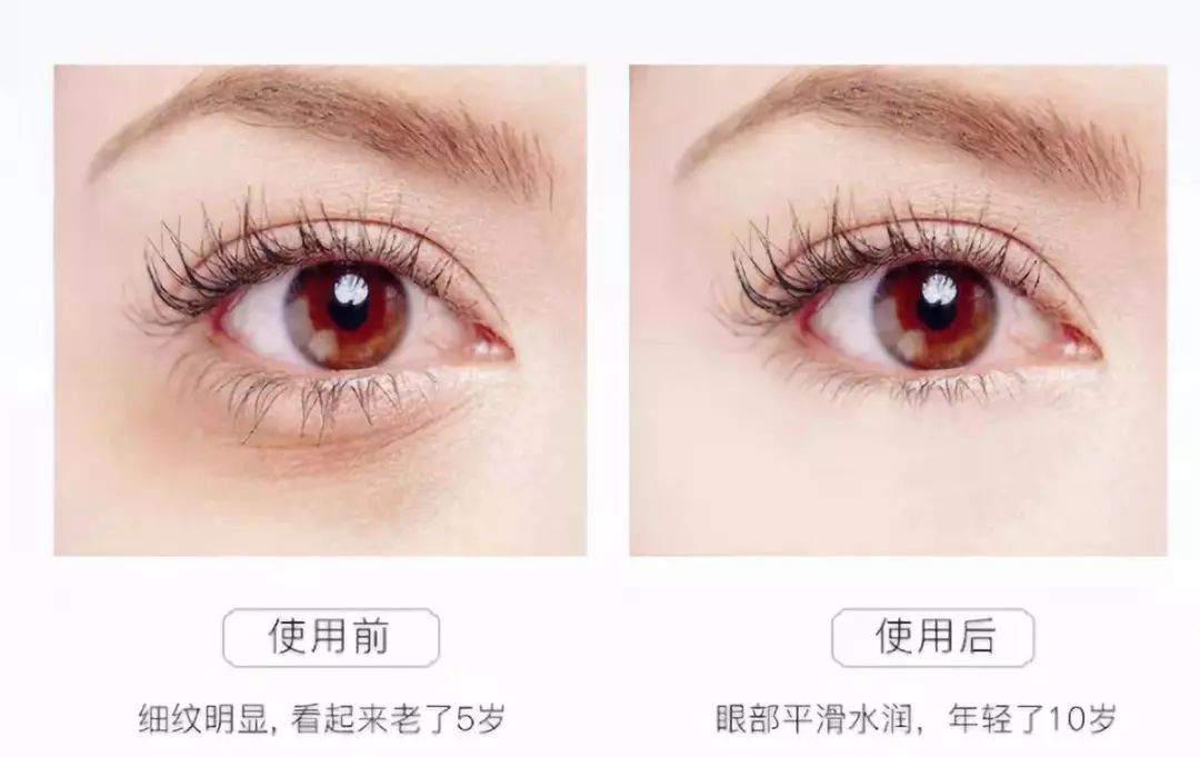 淡纹淡黑眼圈的眼膜推荐,眼纹黑眼圈眼膜推荐