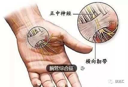 手指麻木刺痛,手指手术后麻木康复训练法