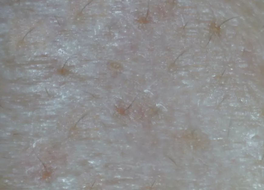 毛孔粗大清洁测评,暗沉粗糙毛孔粗大测评