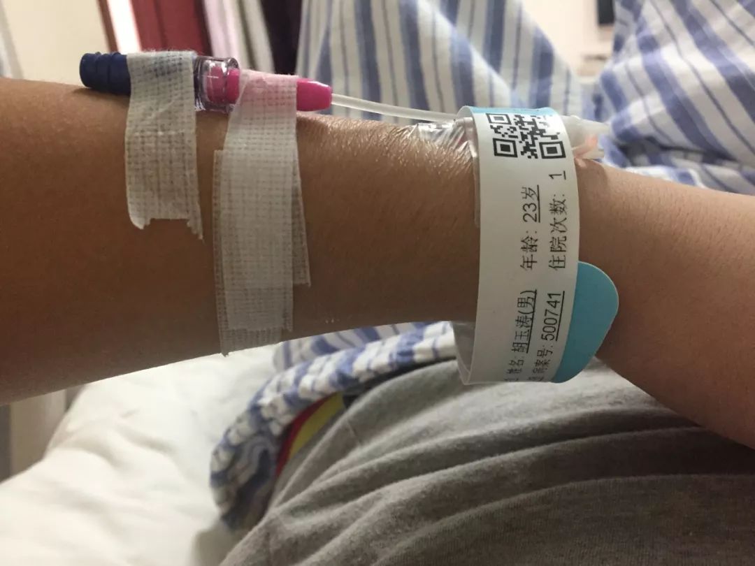 俄罗斯留学生骨折截肢,留学生意外被截肢