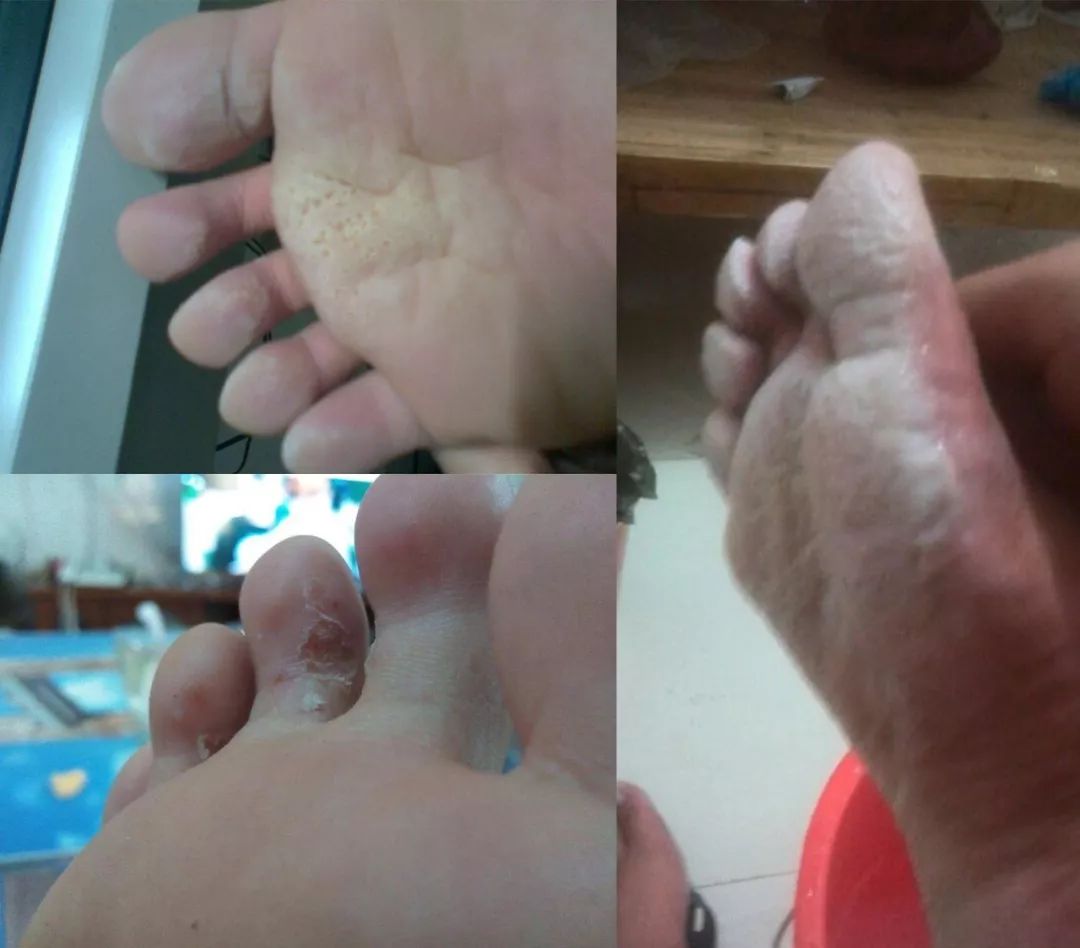 这颗小白球，居然彻底治愈了我的脚臭，日本家庭必备的除臭杀菌神物，三分钟还你一个清新的“脚气”！