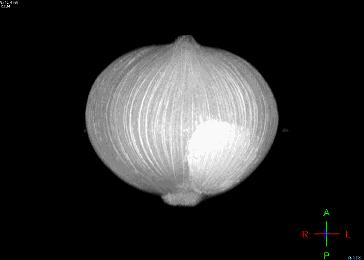 核磁共振对人体的副作用有哪些,核磁共振增强伤身体吗