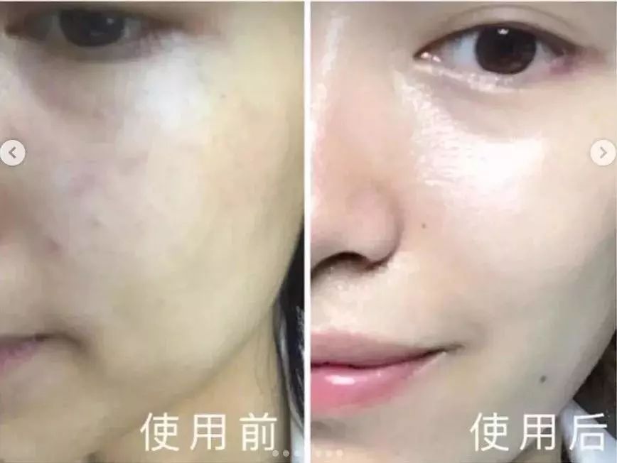 张嘉倪同款月光宝盒精华液,张嘉倪给人涂保湿美白精华液