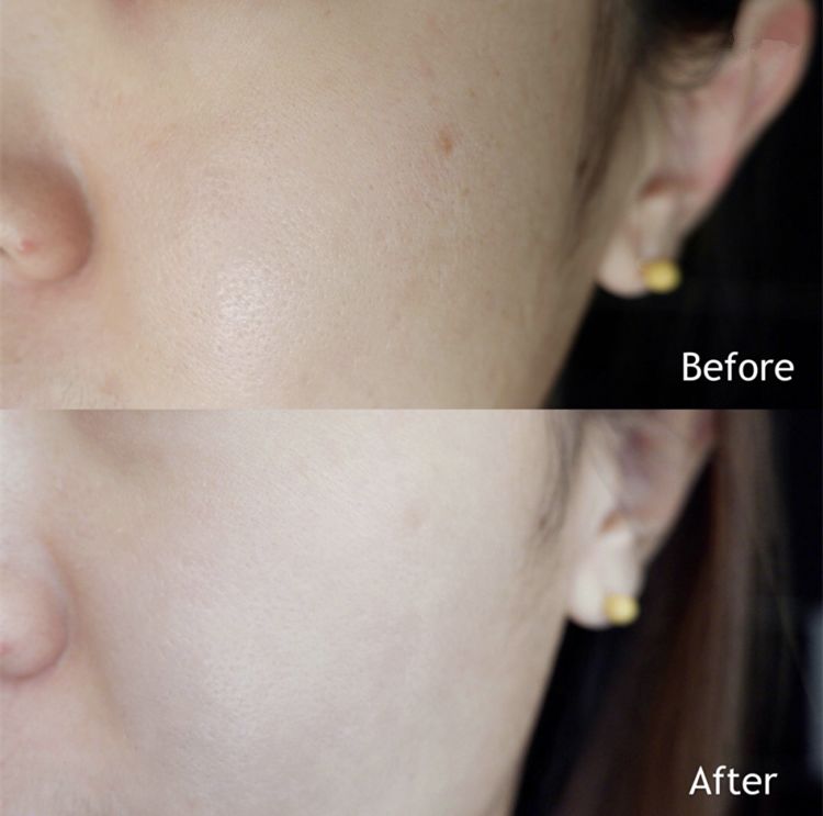 护肤小红书都在推荐的安瓶面膜,护肤补水推荐小红书