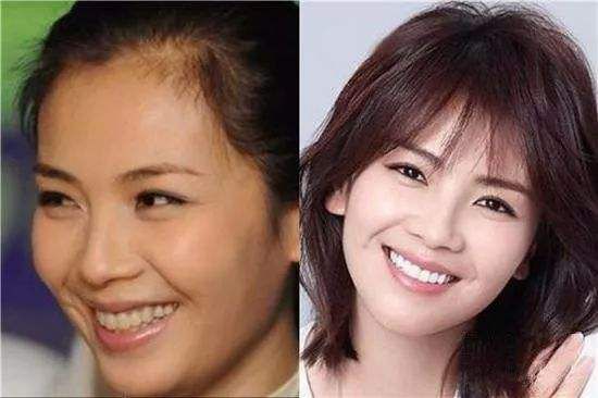 公认去牙黄最好的牙膏老爸评测,去牙渍去口气的牙膏测评