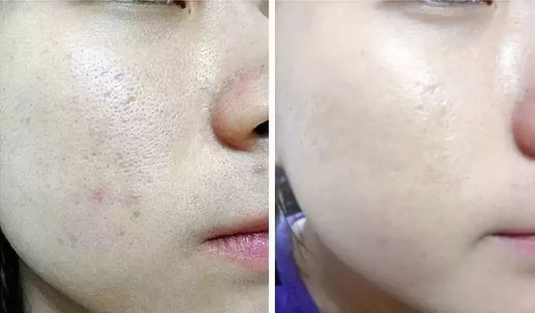 刘涛真人秀用的化妆品,刘涛林允素颜视频