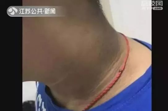 男孩子脖子黑洗不掉怎么办,男孩脖子老是不舒服是怎么回事