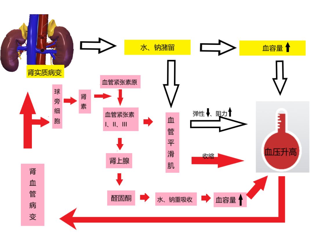 超声技术在肾性高血压中的应用