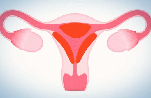 鍏充簬鏈堢粡琚瑙嗙殑妗堜緥,鏈堢粡缇炶颈