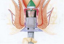 协和名医林国乐,协和林国乐讲座