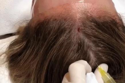 张雨绮猪油抹脸,张雨绮猪油膏