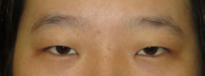 假小子变装惊艳全场的样子,肿眼泡假小子