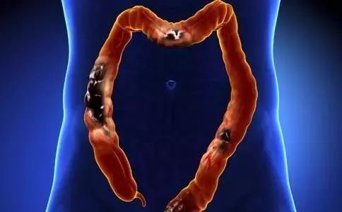 健康亮红灯有什么预兆,健康红灯怎么消除