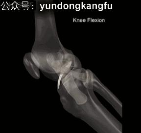 膝腓侧副韧带损伤怎么恢复,膝内侧副韧带损伤修复视频