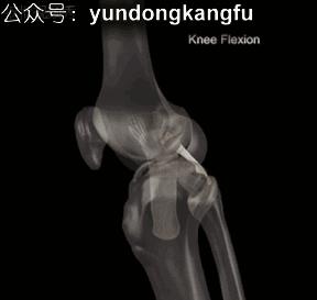 膝腓侧副韧带损伤怎么恢复,膝内侧副韧带损伤修复视频