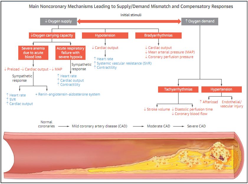 急性st段抬高型心肌梗死指南2019,什么是急性非st段抬高型心肌梗死