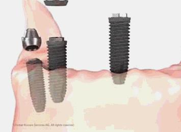 福州市民凭身份证免费牙齿矫正,身份证520开头免票