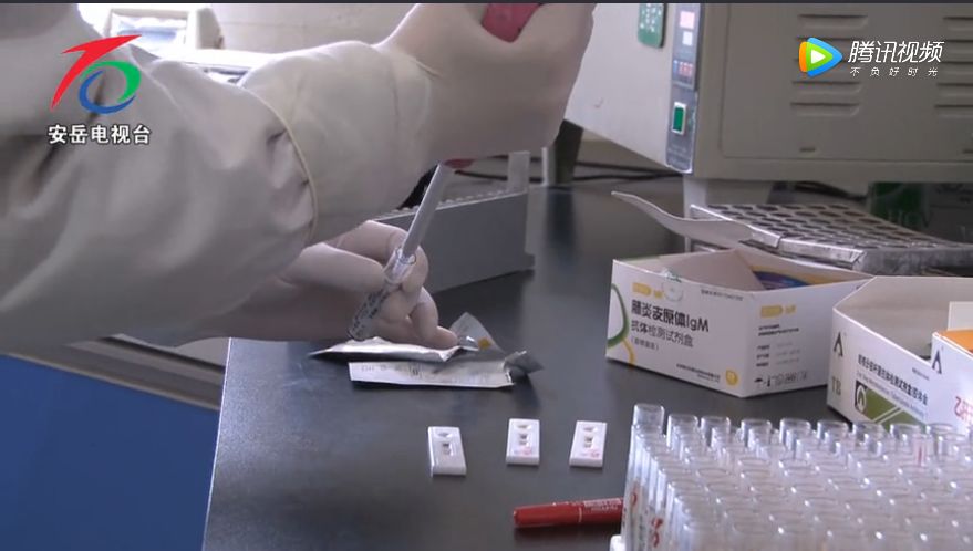 去人民医院检测艾滋挂什么科,梅毒艾滋病检查去哪个科室