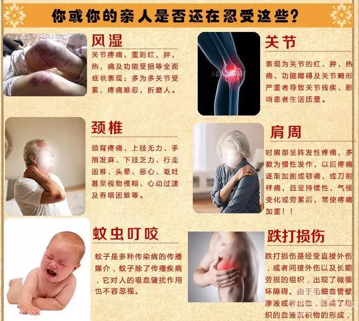 千里追风膏有什么用,本土千里追风膏